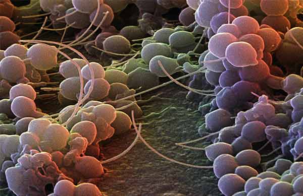 Fungal infections in the human body